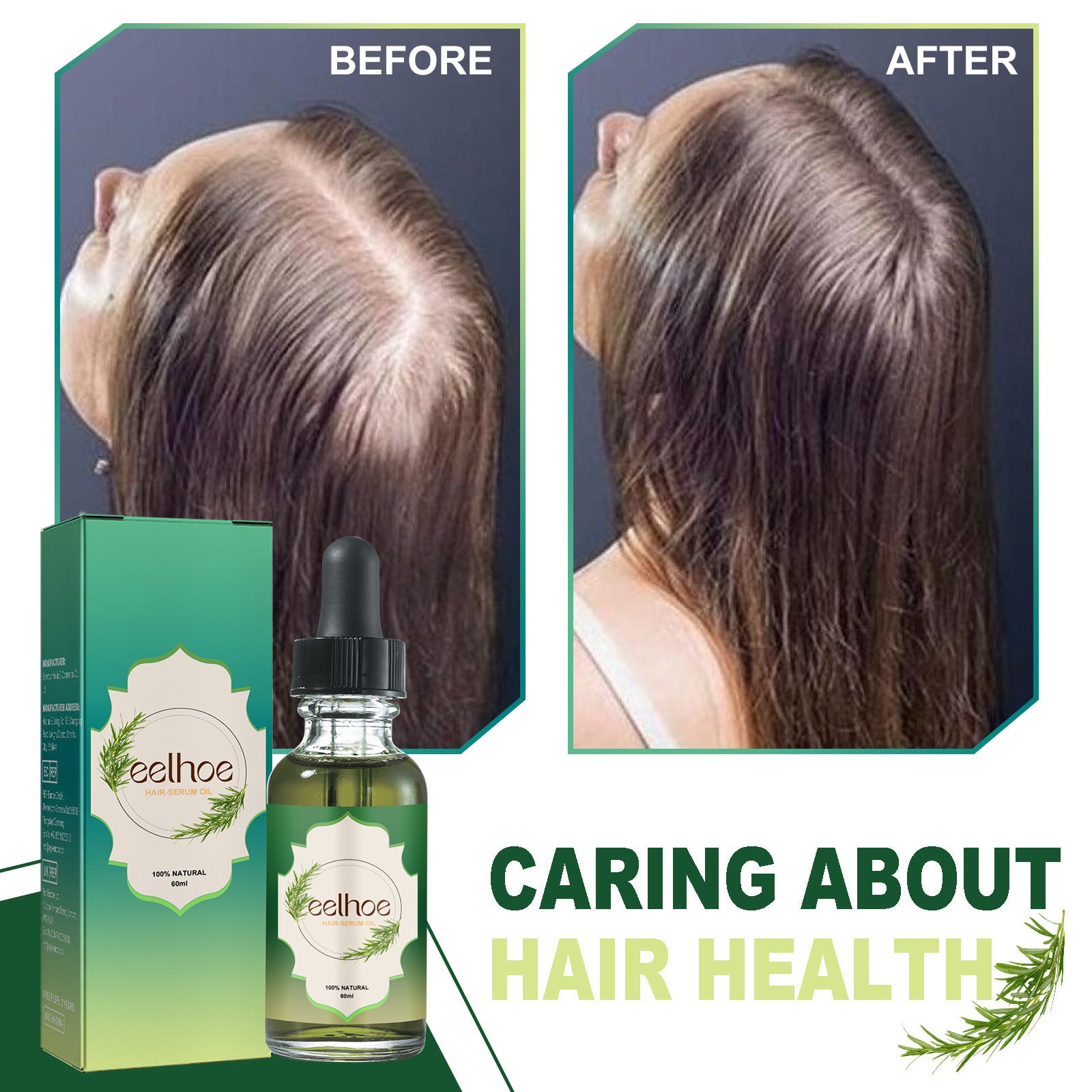 #HairCare,
#AntiHairLoss,
#ThickHair,
#HairNourishment,
#HealthyHair,
#HairGrowth,
#StrongerHair,
#FullerHair,
#HairRevival,
#StopHairLoss,
#HairStrength,
#HairWellness,
#NourishedHair,
#HairRegrowth,
#ThickerLocks,
#HairTreatment,
#ScalpCare,
#HairHealth,
#VolumeBoost,
#HairEssentials
